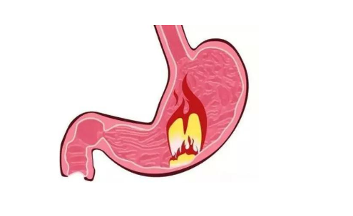 萎縮性胃炎嚴重嗎，它會造成 什么危害呢