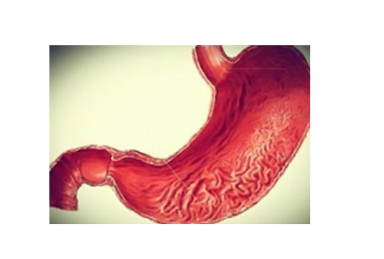 萎縮性胃炎能治好嗎，以下內容來告訴你